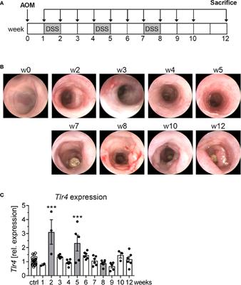 Inhibition of TLR4 Signaling Impedes Tumor Growth in Colitis-Associated Colon Cancer